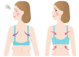 Axillary Breast Removal