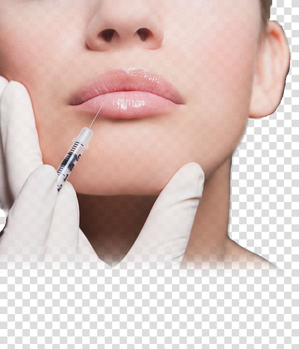 Lip Augmentation