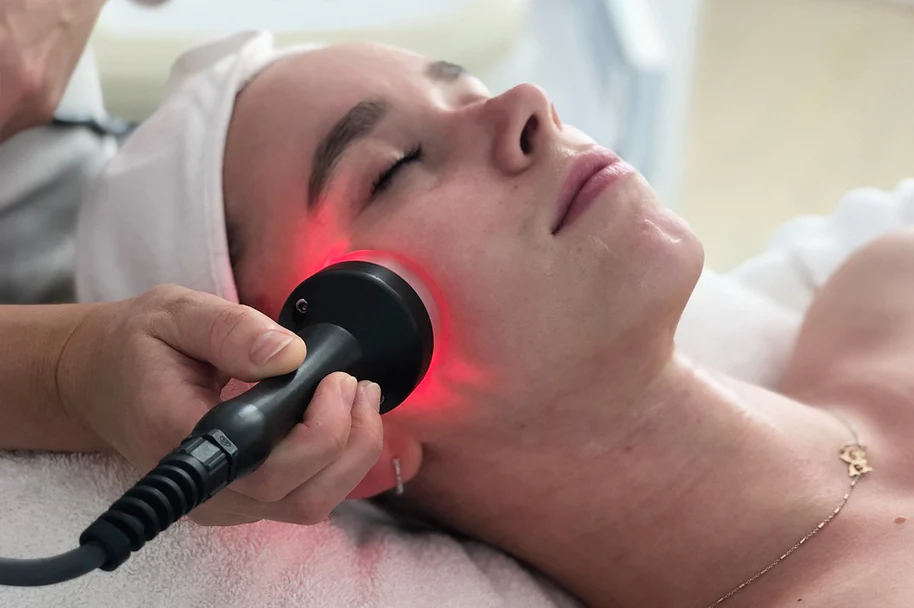 Radiofrequency Tightening